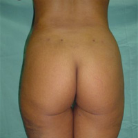 antes