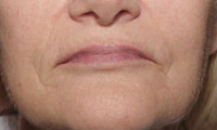 antes