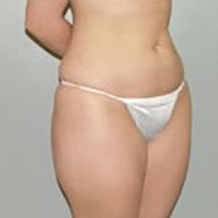 antes